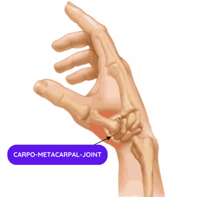 Understanding CMC Thumb Pain: Causes, Symptoms, and Solutions